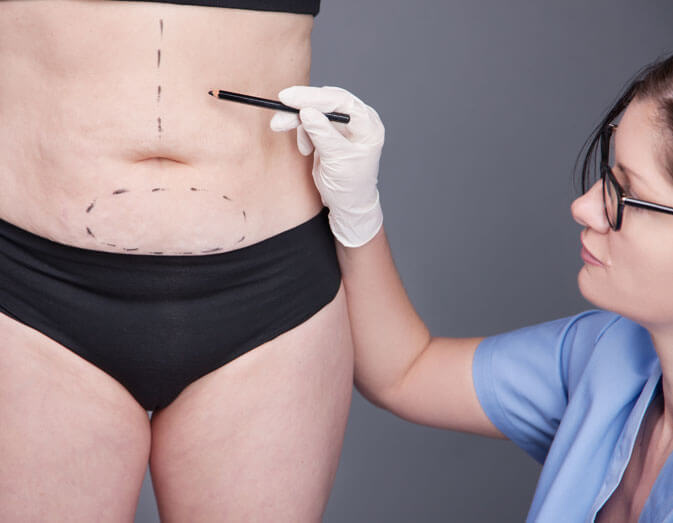 abdominoplastie circulaire turquie