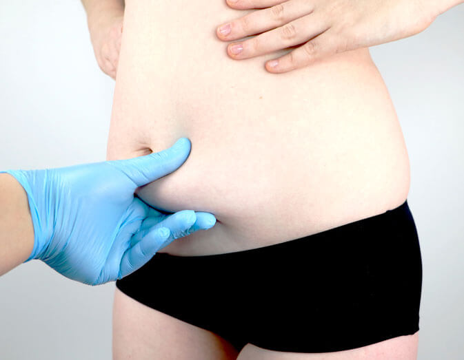 abdominoplastie complete turquie